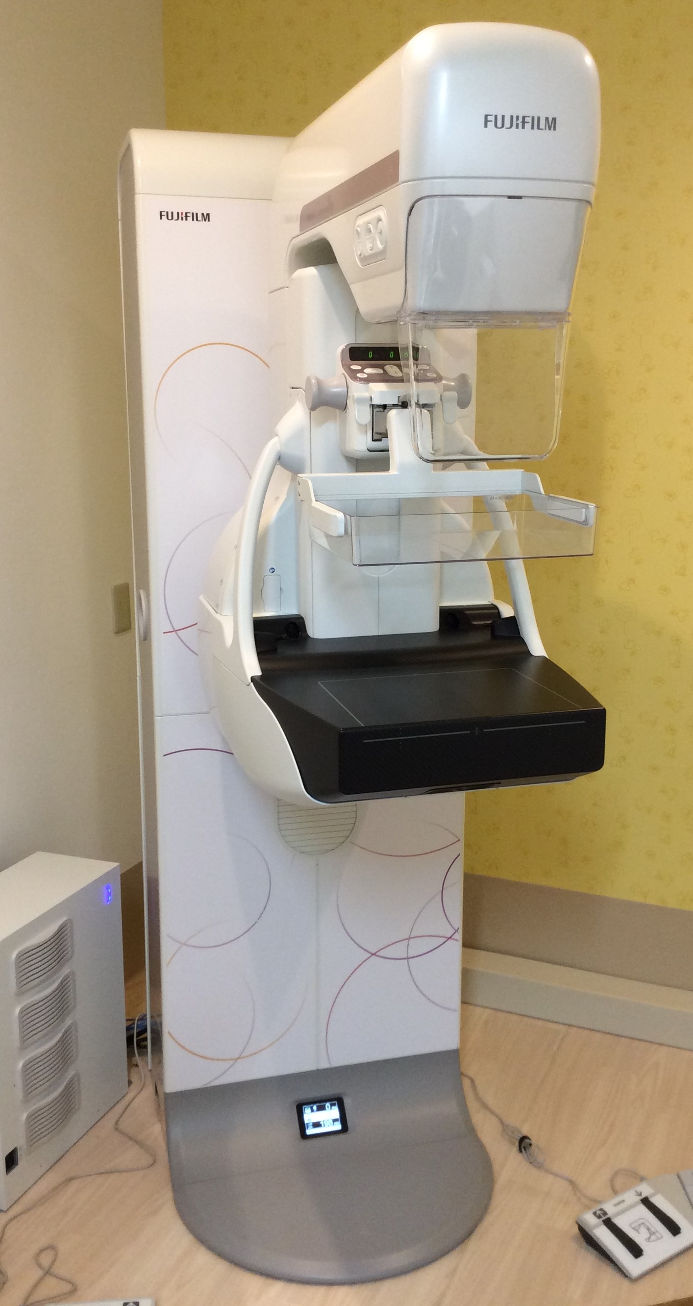 デジタル乳房X線撮影(マンモグラフィ)装置